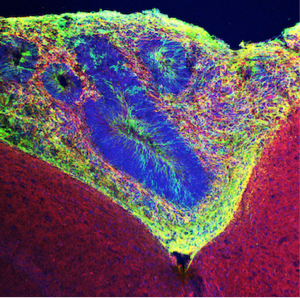 Human-organoid-tissue-green-grafted-into-mouse-tissue.-Neurons-are-labeled-with-red-dye.
