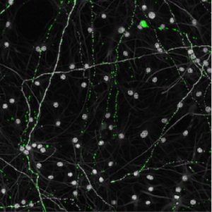 Aged-mitochondria-green-in-old-neurons-gray-appear-mostly-as-small-punctate-dots-rather-than-a-large-interconnected-network-300x301