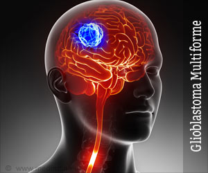 glioblastoma-multiforme