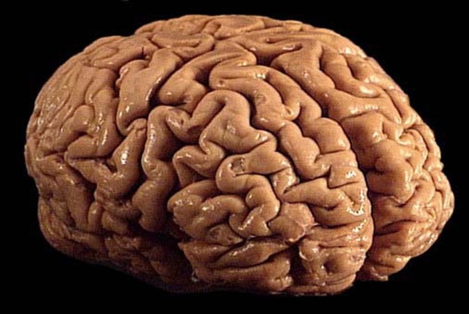 Brain_01