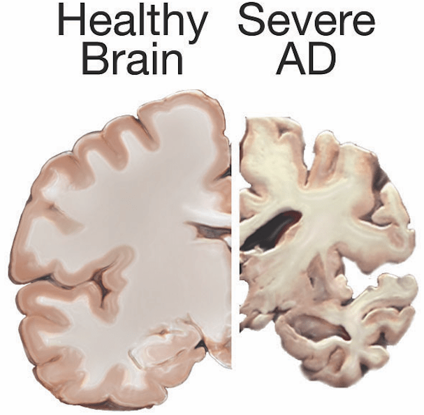 Screen Shot 2018-08-01 at 12.10.55 PM