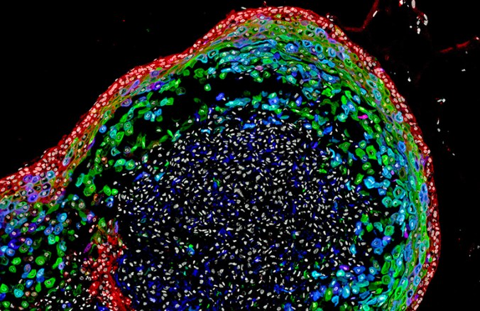 Cincinnati-Childrens-Hospital-esophageal-organoid