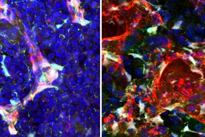 How-Stem-Cells-Act-When-Stressed-Versus-When-At-Rest