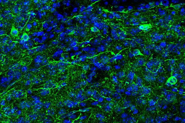 dopaminergic neurons-1