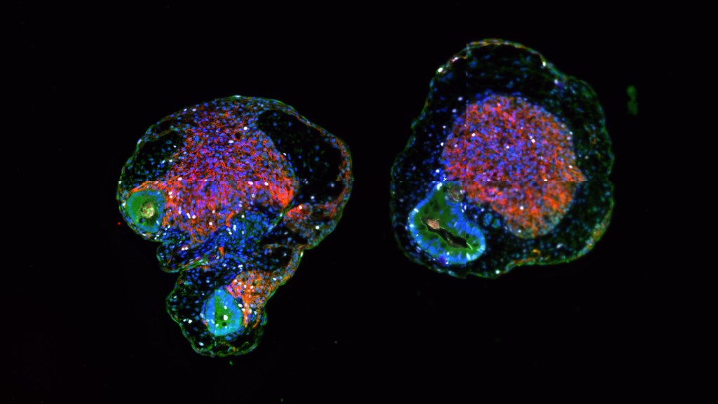 Microscopy image of the new type of organoid created by Todd McDevitt, Ana Silva, and their colleagues in which heart tissue (red, purple, and orange masses) and gut tissue (blue and green masses) are growing together. Captured by Ana Silva.