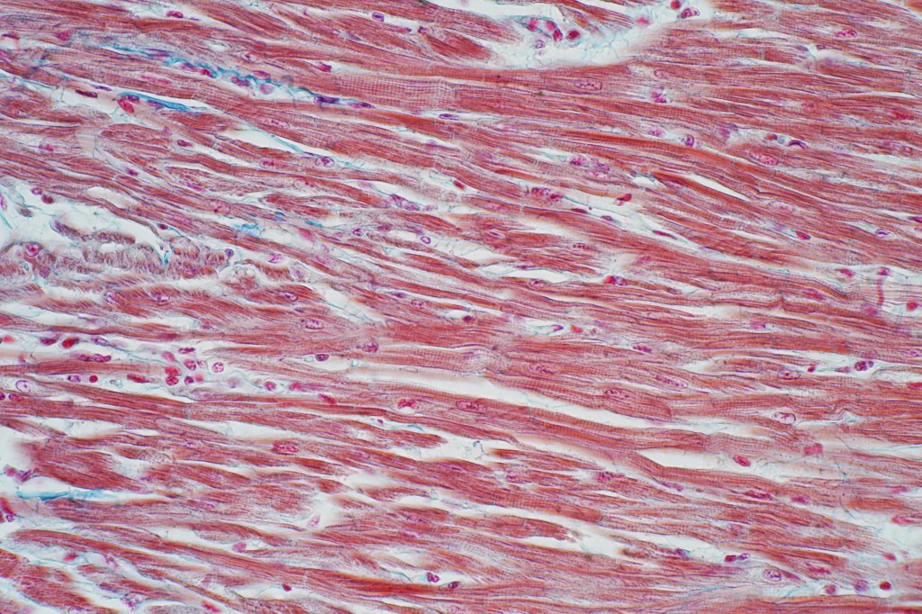 Histology of human cardiac muscle under microscope