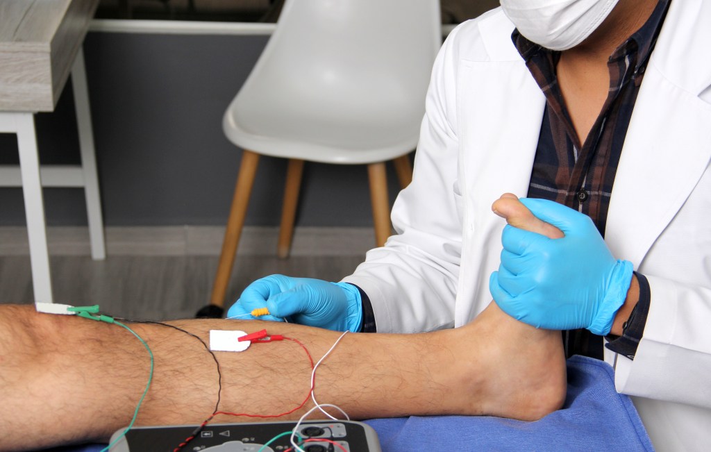 Electromyography in the lower limbs, a graphic recording technique of the electrical activity produced by the tibial muscle, performed by a specialist neurologist.
