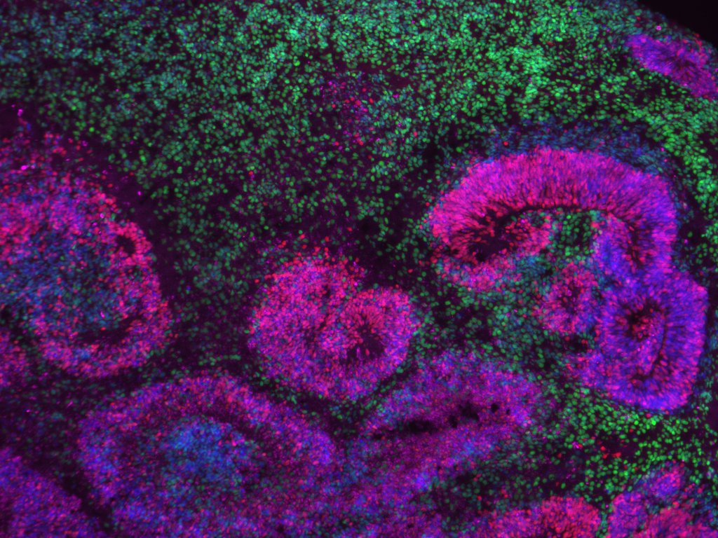 Close up image of a mini organoid from the Bhaduri Lab
